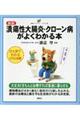 潰瘍性大腸炎・クローン病がよくわかる本 新版