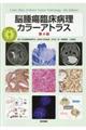 脳腫瘍臨床病理カラーアトラス 第4版