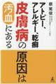 �A�g�s�[�A�A�����M�[�A��᝔畆�a�̌����͉����ɂ���