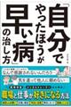 「自分でやったほうが早い病」の治し方