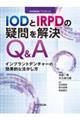 IODとIRPDの疑問を解決Q&A