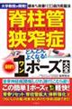 脊柱管狭窄症どんどんよくなる!劇的1ポーズ大全