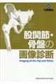 股関節・骨盤の画像診断