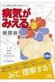 病気がみえる vol.2 第6版